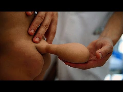 Fazla Organla Doğan İbretlik15 İnsan